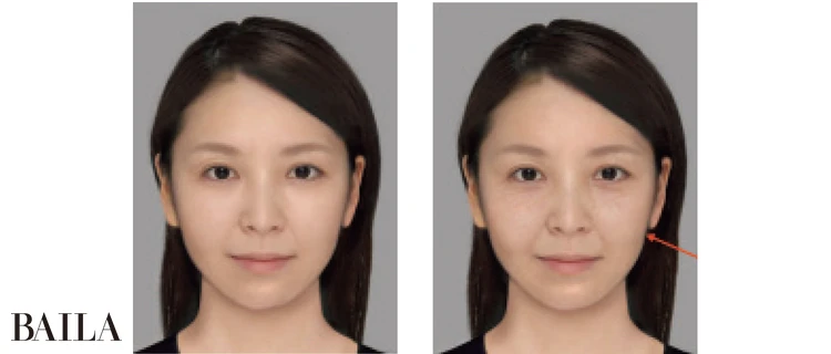 たるみ顔に効かせるスキンケア＆マッサージ＆美容医療（写真）_0