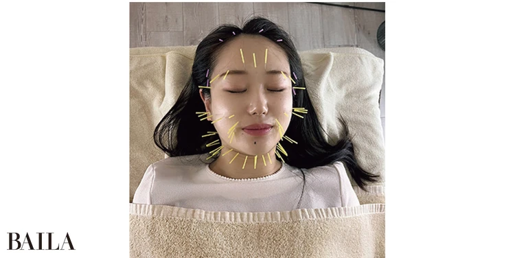 ボトックス、美容鍼、脂肪溶解注射が最近のマイブーム。未来の自分への投資です!(28歳・商社)