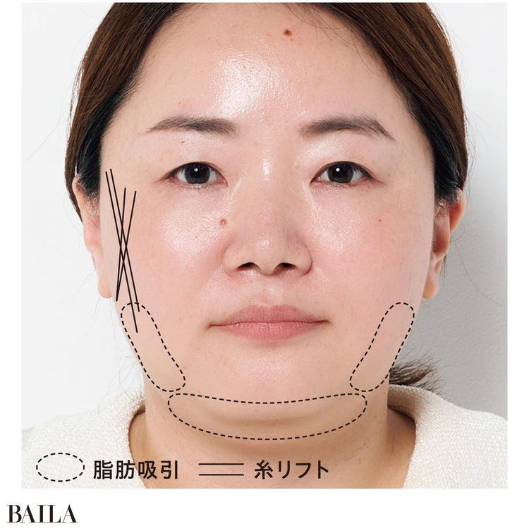 【カウンセリングのみ】ライター谷口