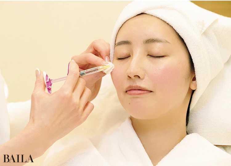 いざ注入! 麻酔クリームを使用するため痛みはほぼなし。