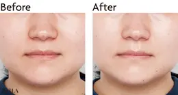 大人の肌特有のしぼみや乾燥によるくすみ感をケア。ハリ感をアシストし、頰のツヤ玉位置も上へ！