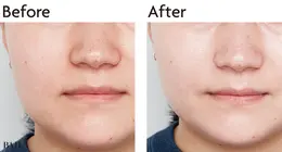 ソフィーナ iP　スキンケアUV 03 ビフォー＆アフター