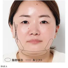 【カウンセリングのみ】ライター谷口