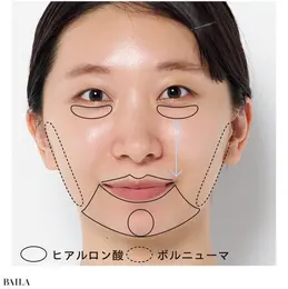 【カウンセリングのみ】編集M