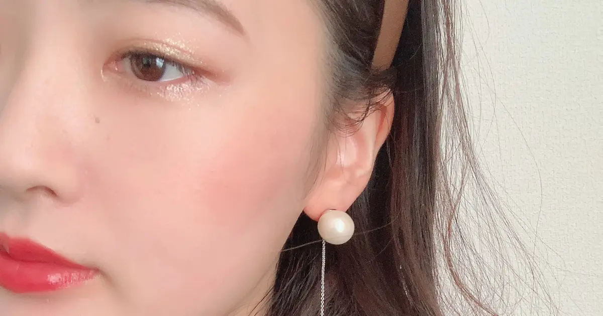 ほくろ除去 費用や経過について Baila