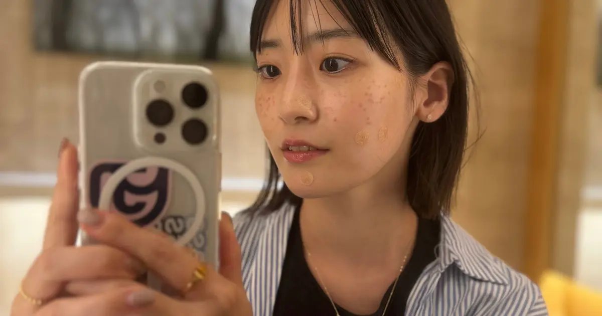 【韓国でシミ取り】本当は教えたくないソウルの皮膚科クリニック