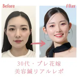 【一覧】みんなが使っているツヤ肌コスメ＆テク_1_1